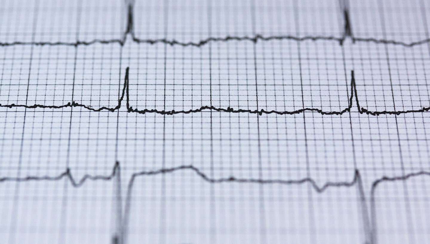 Cobb Internal Medicine on site diagnostic services.